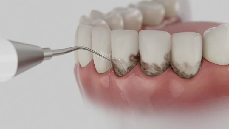 Reliable Root Canal Treatment contractor in Calloway County County, KY by Dentist Open Now